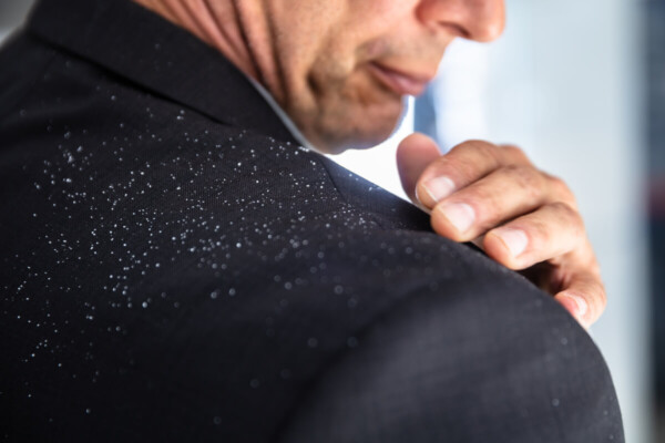 Man brushing dandruff flakes off of his suit jacket