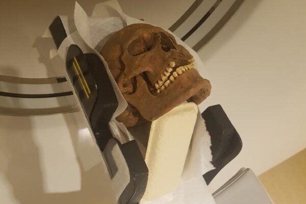 Viking-era skull