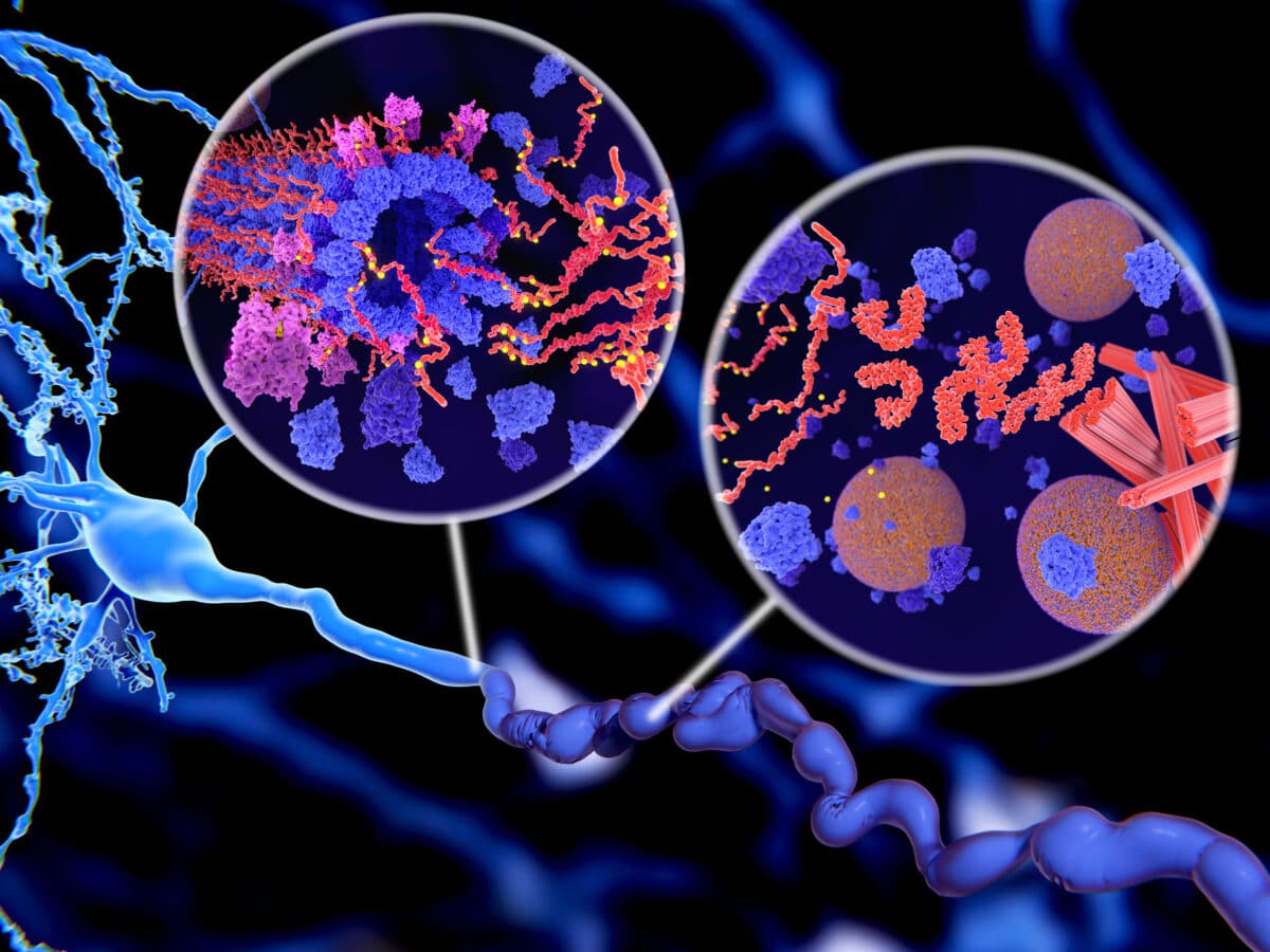 Alzheimer's disease: Pathological Tau protein (red-orange) phosphorylation (yellow) leads to disintegration of microtubuli and aggregation to neurofibrillary tangles (orange) in a neuron axon.