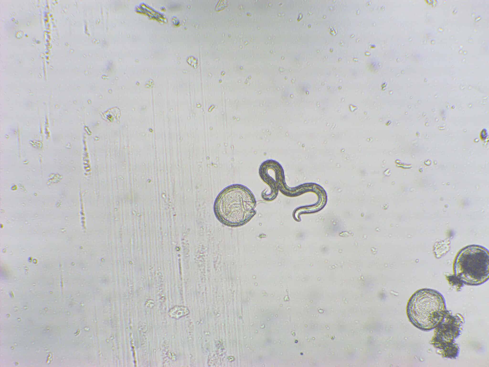 Toxocara canis (Roundworm)