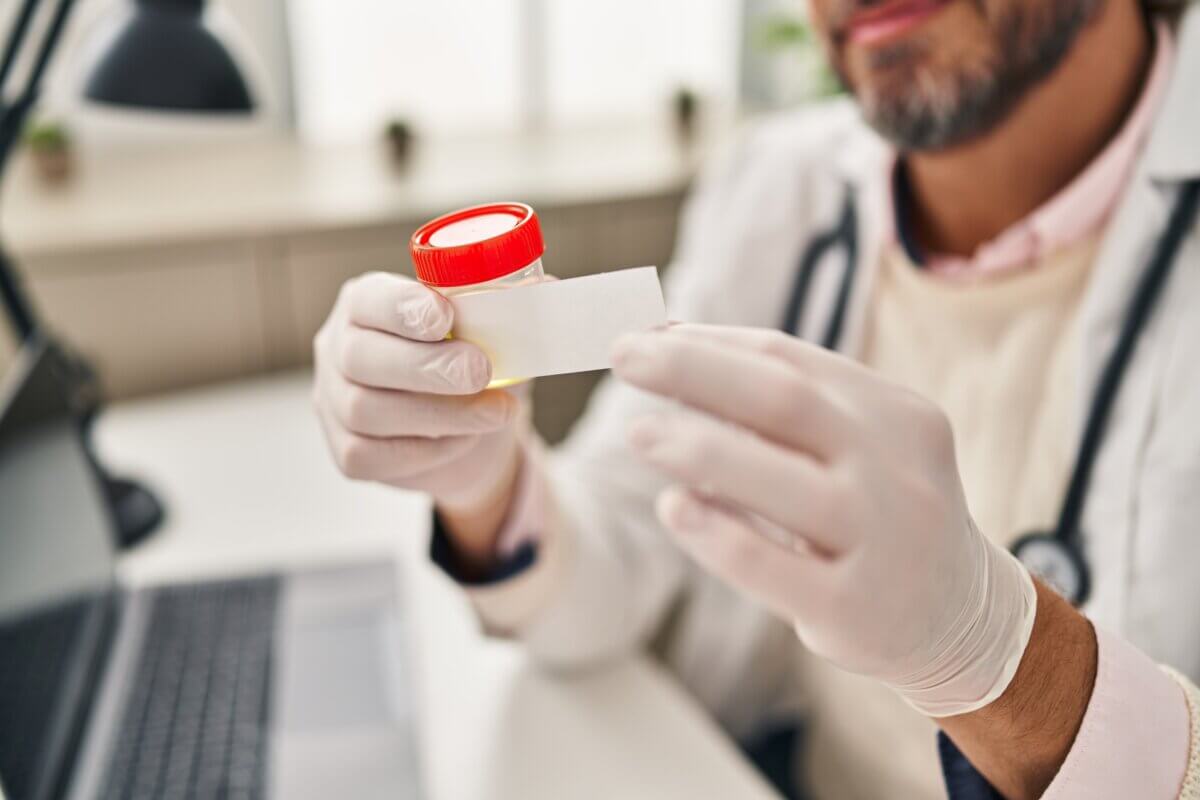 Urine sample test in the lab